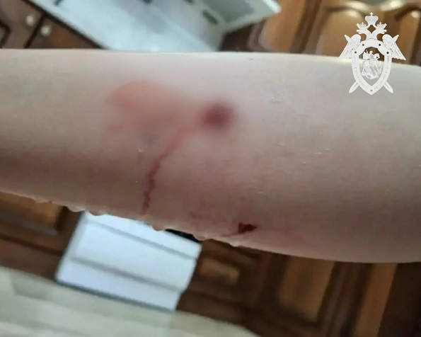 Нападение собак на детей в Минеральных Водах: СК возбудил дело о халатности Нападение собак на детей в Минеральных Водах: СК возбудил дело о халатности
